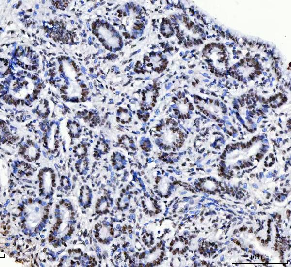 IHC - Anti-CPSF6 Antibody Picoband™ (monoclonal, 3F11E1) ABO16592